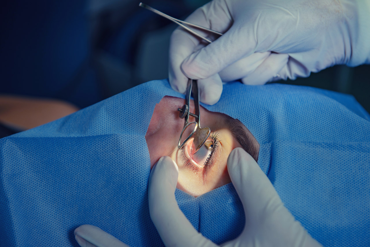 Cirurgia de glaucoma - Dra. Camila Porto